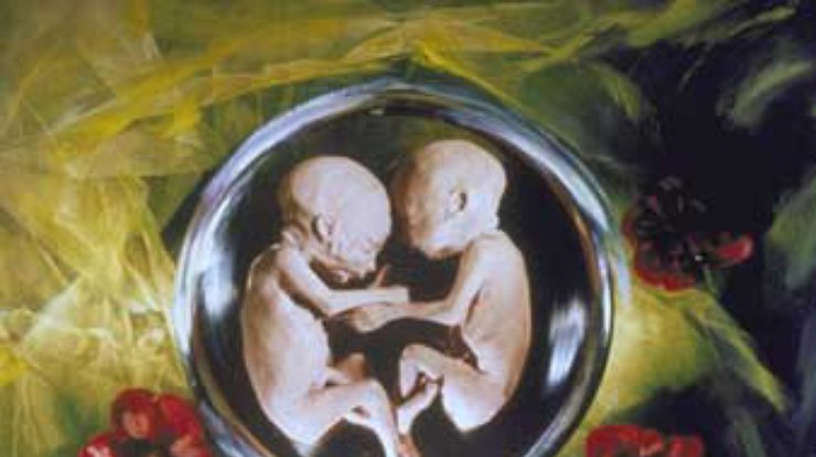 Ученый, создавший Долли, намерен клонировать эмбрион человека