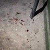 На исполняющего обязанности мэра Запорожья совершено нападение