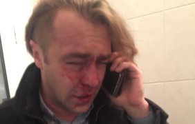 Свободовца Игоря Мирошниченко избил любовник жены