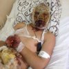 Танкист России, раненный под Дебальцево: мы знали, на что идем (фото, видео)