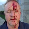 Журналистов избивали до крови во время беспорядков Балтиморе (фото, видео)