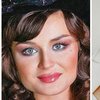 Полина Гагарина до и после операции: превращение в blonde beauty (фото, видео)