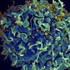 Вирусологи нашли способ останавливать развитие ВИЧ