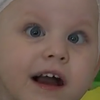 Трирічна Карина потребує термінового лікування від гідроцефалії (відео)