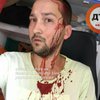 В Киеве водитель внедорожника битой избил велосипедиста (фото)