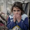 Путин бомбит Сирию: соцсети ведут счет убитым детям