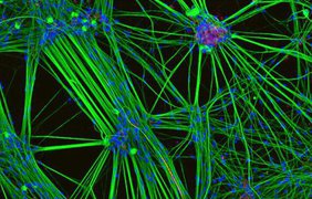 Нейроны, выращенные из клеток кожи человека. Автор: Ребекка Натбраун