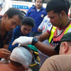 В Тайланде туристу из России отрезали ухо на рынке (фото)
