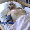 На Сумщині пенсіонера намагалися вбити за 42 гривні