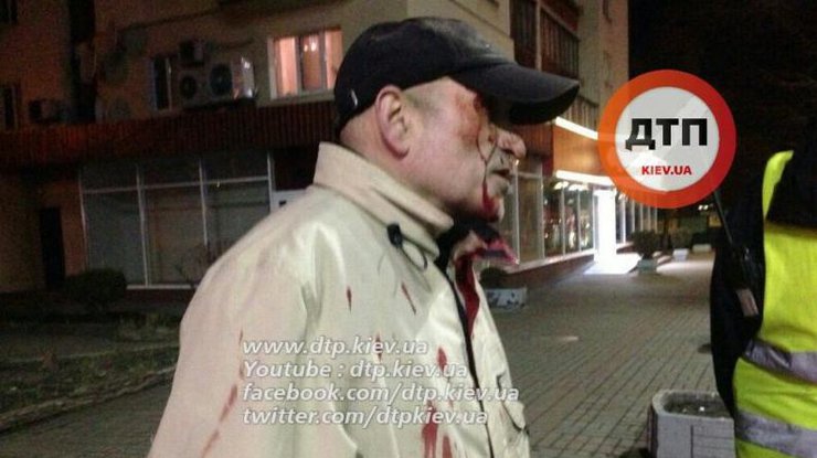 В Киеве пьяный мужчина бросился под колеса автомобиля