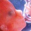 Ученые вырастили удивительный эмбрион человека 