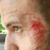 В Запорожье избили журналиста "Громадське ТБ" (фото) 