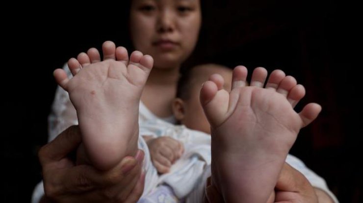 В Китае родился ребенок с 31 пальцем. 