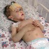 В Одессе разыскивают родителей избитого ребенка (фото)