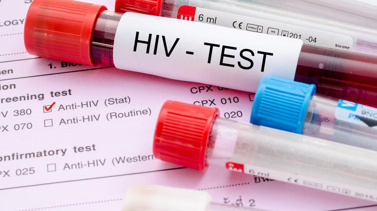 Украина показала неутешительную статистику заражения ВИЧ