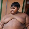 В Индонезии 192-килограммового мальчика посадили на диету (фото)