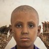 В Бангладеше мальчик превращается в дерево (фото)