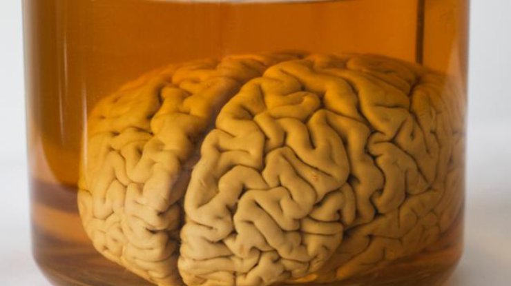 Великобритания передала Бельгии 3 тысячи образцов мозга человека