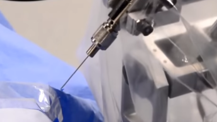 В Бельгии робот-хирург впервые провел операцию на глазах. Фото: кадр из видео