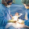 Кесарево сечение: врачи научились делать операцию без швов