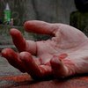 "Рука осталась висеть на ниточке мышц": в Херсоне искалечили мужчину 