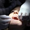 Аномалия тела: у женщины в носу вырос зуб (фото) 