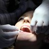 Болезнь зубов: какие привычки уничтожают нашу эмаль 