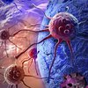 Лекарство от рака: ученые предложили необычный способ лечения болезни
