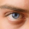 Глаукома: признаки, симптомы и лечение болезни 