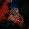 Жуткое нападение: в Киеве трое мужчин порезали парня ножом