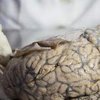 Медики впервые зафиксировали работу человеческого мозга после смерти