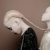 11-летние близнецы-альбиносы произвели фурор в мире моды (фото)