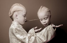 Близнецы-альбиносы из Сан-Паулу покорили мир моды своей внешностью