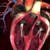 Украинские врачи разработали уникальный сердечный клапан