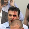 Массовые протесты в Македонии: количество пострадавших перевалило за сто