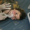 Химическая атака в Сирии: в ООН начали расследование 