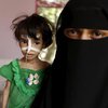 В Йемене зарегистрированы тысячи случаев заболевания холерой