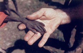 Рука голодающего  Фотография показывает разницу между тем, как выглядит рука обычного человека (миссионера) и кисть ужасно голодного мальчика из бедной африканской страны. Дело было в Уганде в 1980 году.