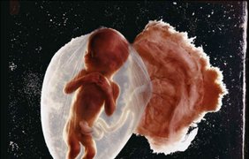 Зародыш человека. Сейчас практически каждая мама может увидеть во время беременности на аппарате УЗИ свое чадо. А вот в 1965 году эта фотография человеческого эмбриона произвела настоящий фурор.