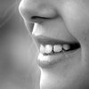 Желтые зубы: ученые назвали неожиданную причину 