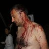 Зверское избиение журналиста под Одессой: подробности случившегося 