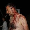 Под Одессой главного редактора местной газеты избили железными битами 