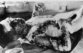Последствия взрыва в Нагасаки