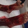 В Австралии подростку обглодали ноги неизвестные существа (фото, видео)