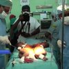 На Мадагаскарі успішно провели операцію з розділення сіамських близнюків