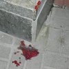 В Киеве подростки жестоко избили прохожего из-за iPhone
