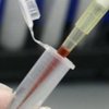 Гепатит А в Николаеве: врачи назвали вероятную причину заражения