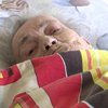 Отрезали по ошибке: после ампутации ноги умерла пенсионерка 