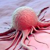 Как уберечь себя от рака: ответ ученых
