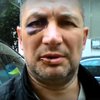 В Крыму мужчину избили и оплевали за украинскую символику (видео)